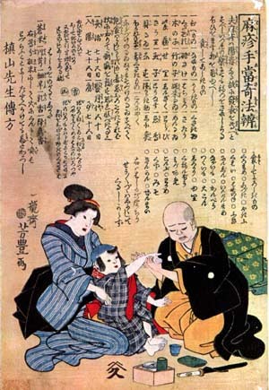 Iconographie chinoise d'une scène de reflexologie palmaire